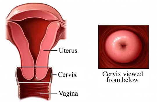 cervix2.jpg